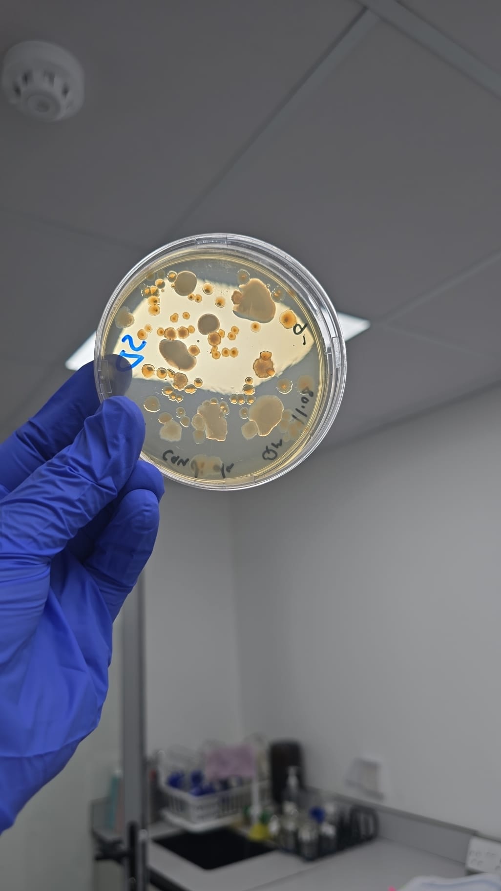 Microbiologist examining microbial culture in petri dish